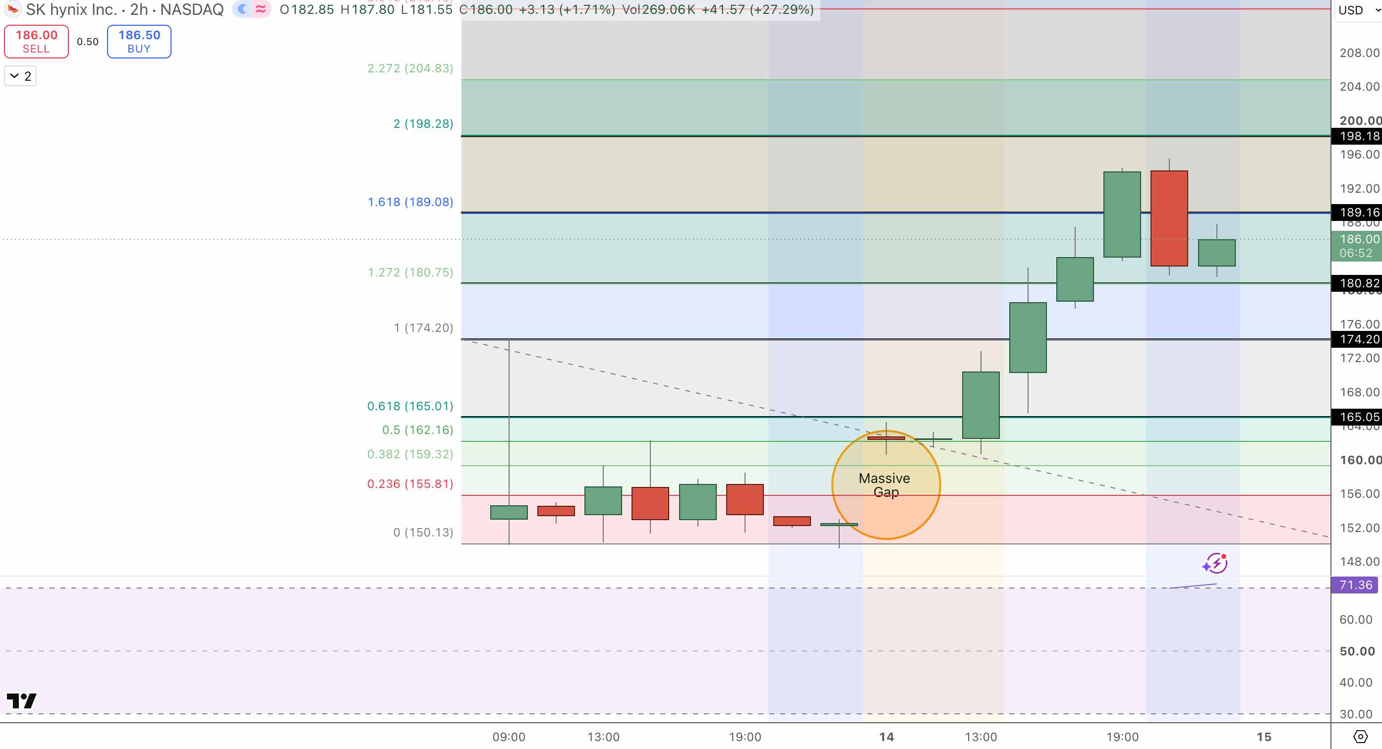 SKHY Price Chart - Source: Tradingview